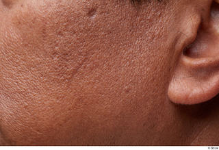 HD Face Skin Enoch Gorat cheek ear face scar skin…